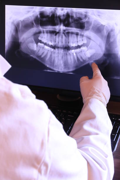 Best Emergency Dental Services for Seniors in Abernathy, TX