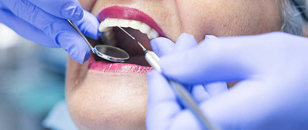 Best Orthodontic Emergency Dentist in Abernathy, TX